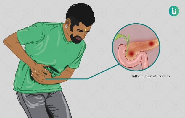 Pancreatitis